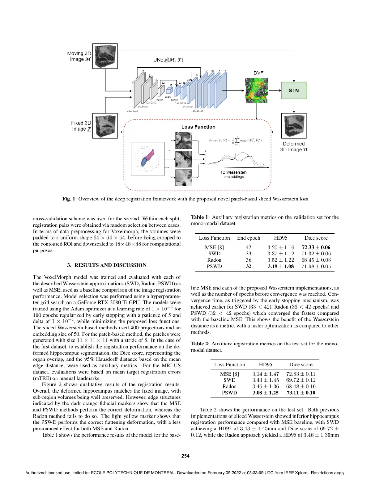 Wasserstein Intensity-based Wasserstein distance for unsupervised registration