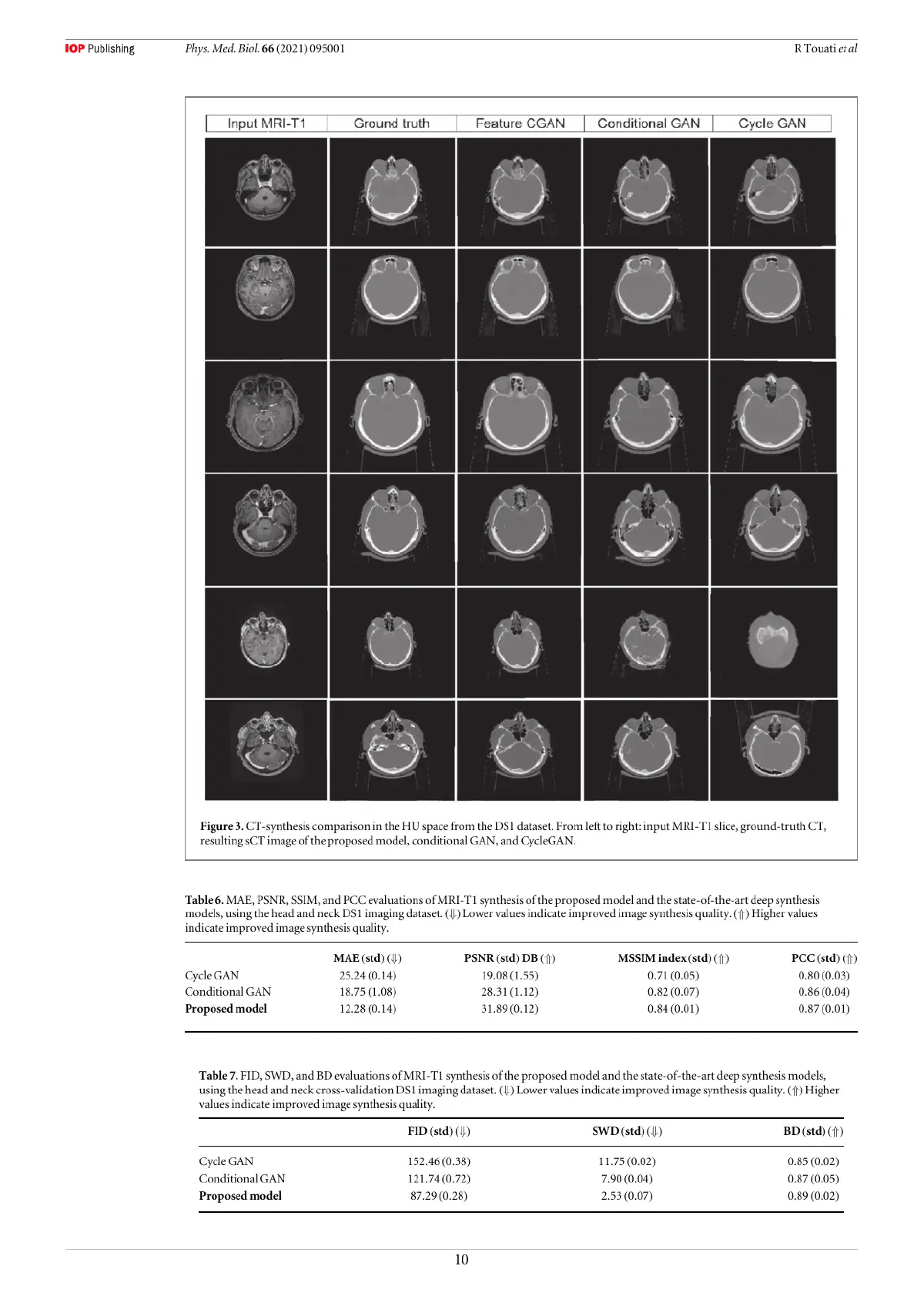 CT synthesis Feature invariant generative adversarial network for head and neck MRI/CT synthesis